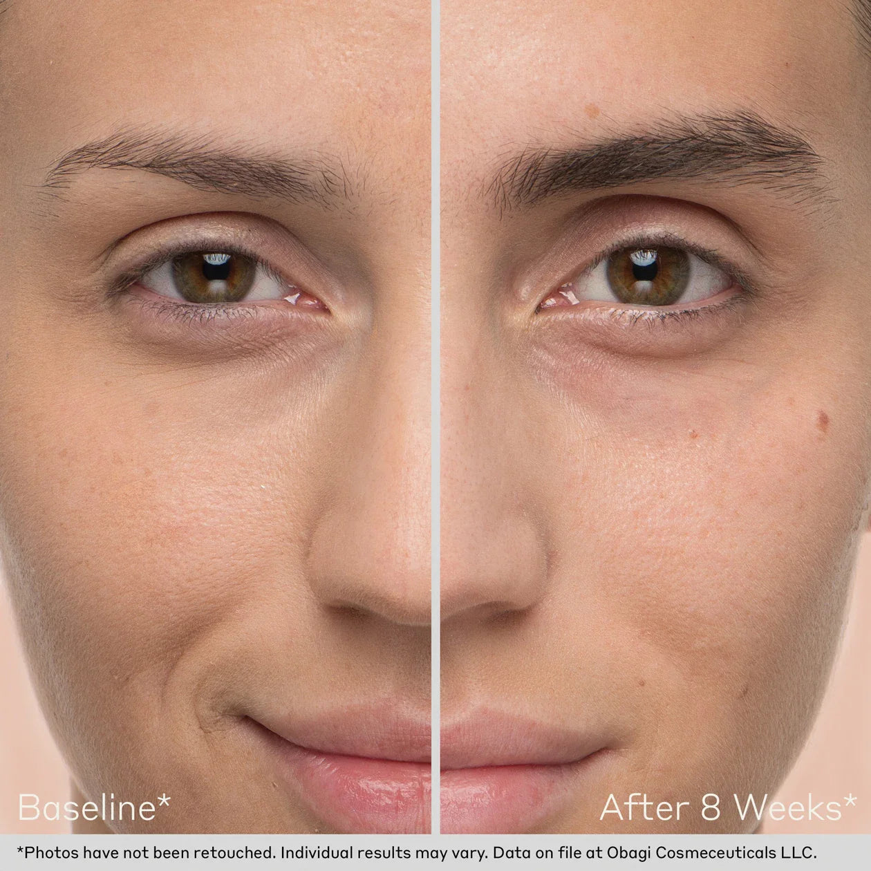 Obagi Nu-Cil™ Eyebrow Boosting Serum