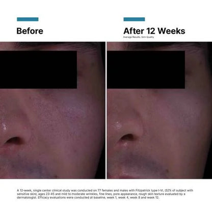 P-TIOX ANTI-WRINKLE CREAM SKINCEUTICALS