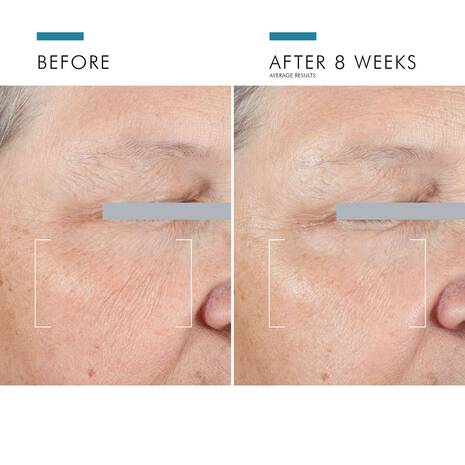 Skinceuticals A.G.E. ADVANCED EYE CREAM FOR DARK CIRCLES