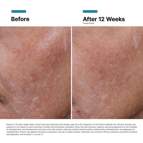 SkinCeuticals HA Intensifier Multi-Glycan