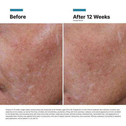 SkinCeuticals HA Intensifier Multi-Glycan