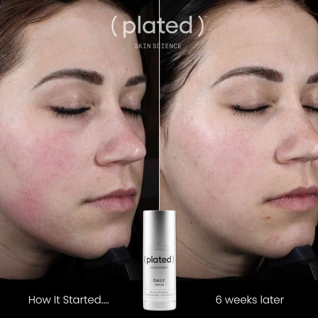 Plated DAILY Serum (DOUBLE THE SIZE OF INTENSE)
