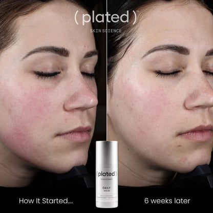 Plated DAILY Serum (DOUBLE THE SIZE OF INTENSE)