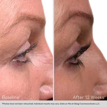 Obagi Nu-Cil™ Eyelash Enhancing Serum