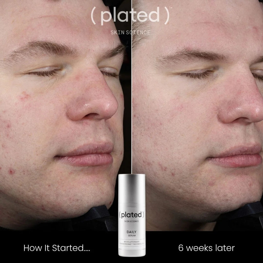 Plated DAILY Serum (DOUBLE THE SIZE OF INTENSE)