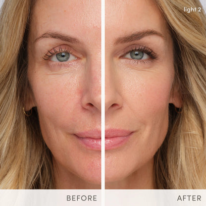After Glow To-Go post-treatment kit (travel kit)