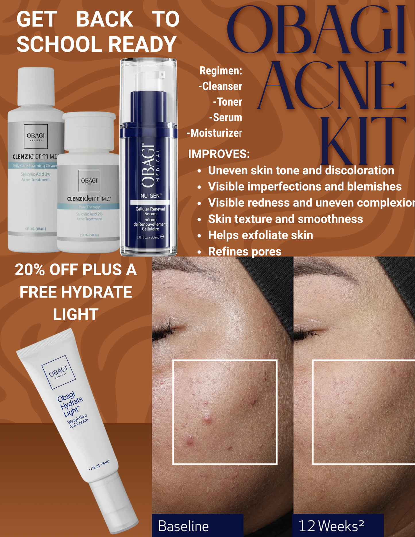 OBAGI ACNE KIT AUGUST SPECIAL