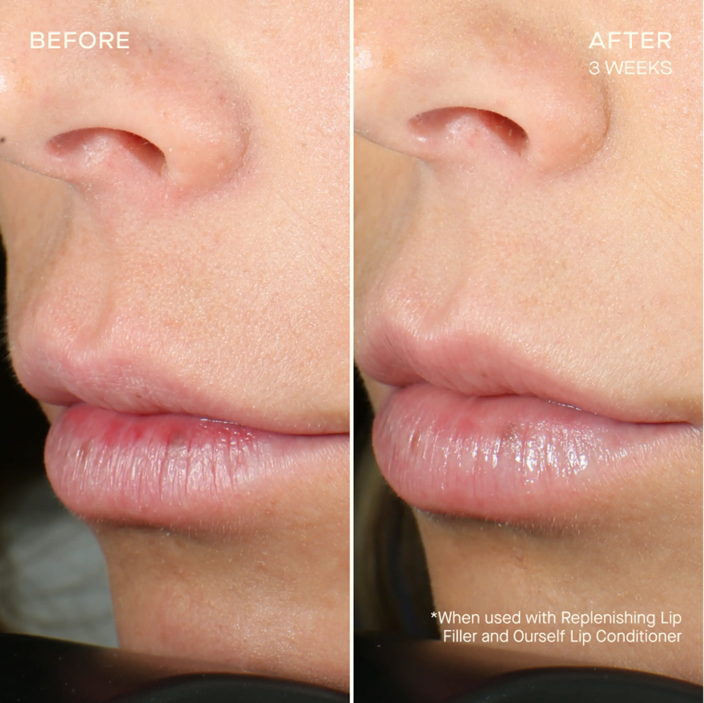 OurSelf Replenishing Lip Filler
