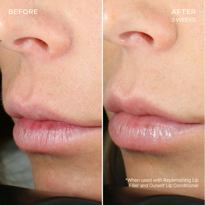OurSelf Replenishing Lip Filler
