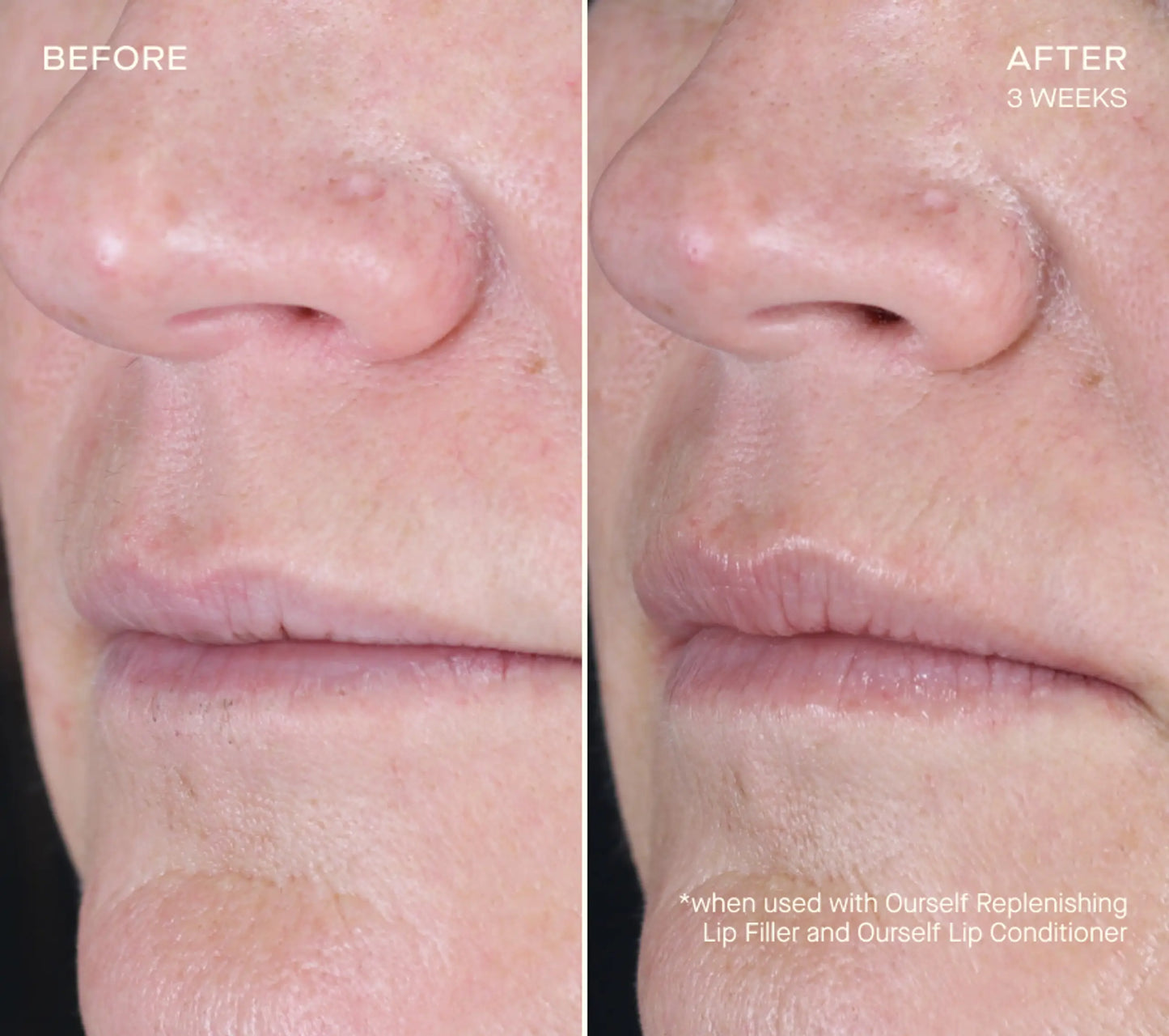 OurSelf Replenishing Lip Filler