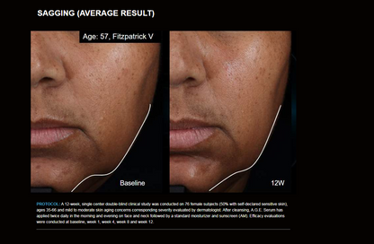 SkinCeuticals A.G.E. Interrupter Ultra Serum