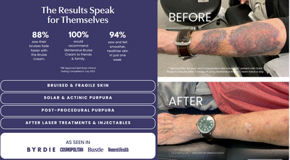 Bruise Cream (Skintensive) 4oz