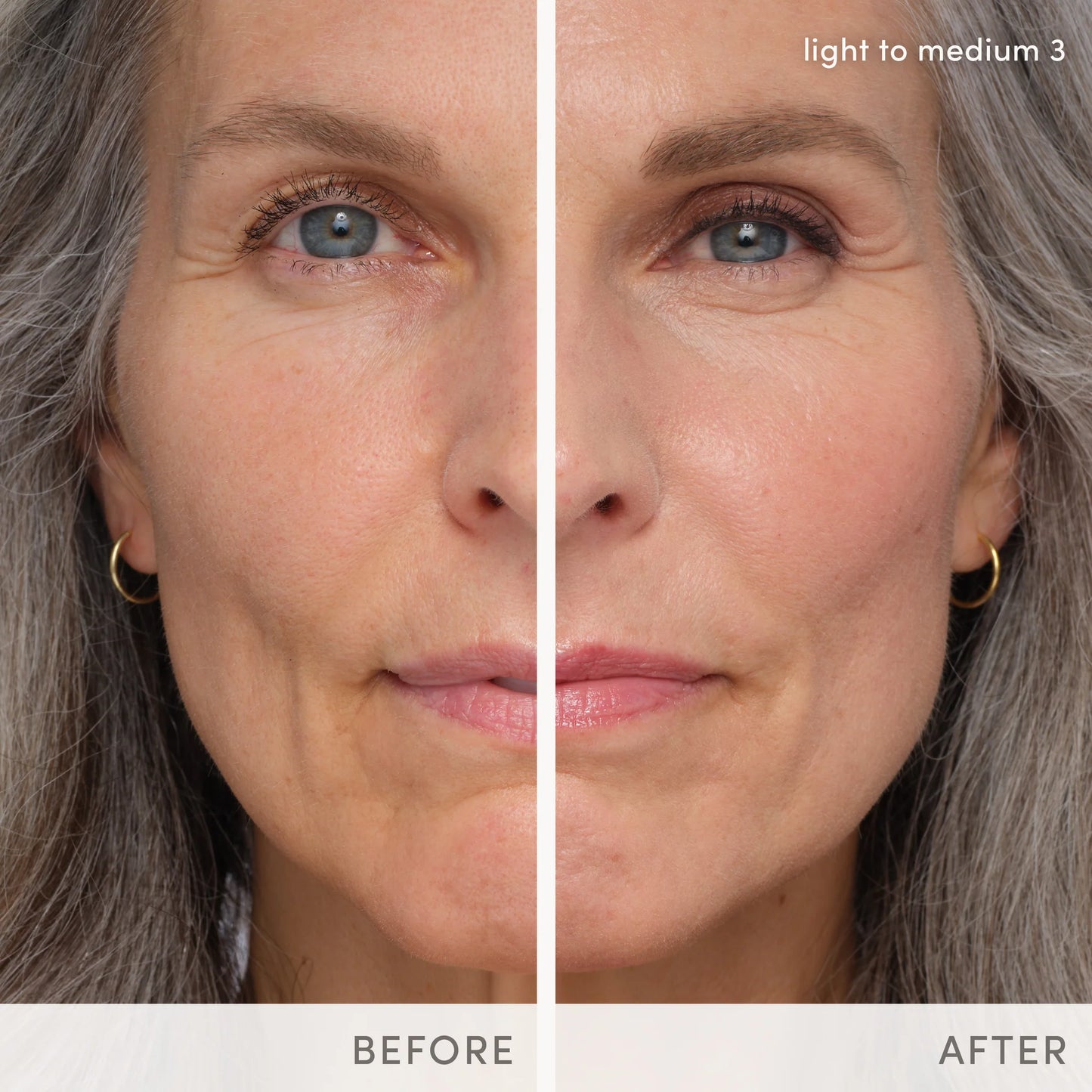 After Glow To-Go post-treatment kit (travel kit)