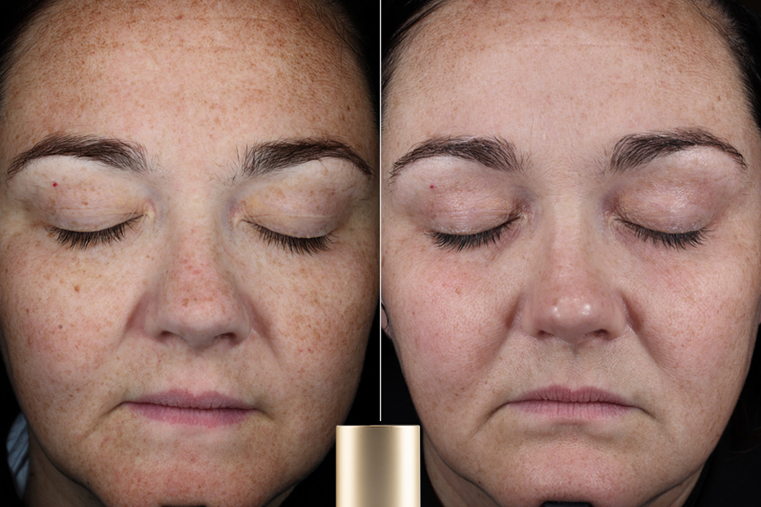 Plated™ INTENSE Serum