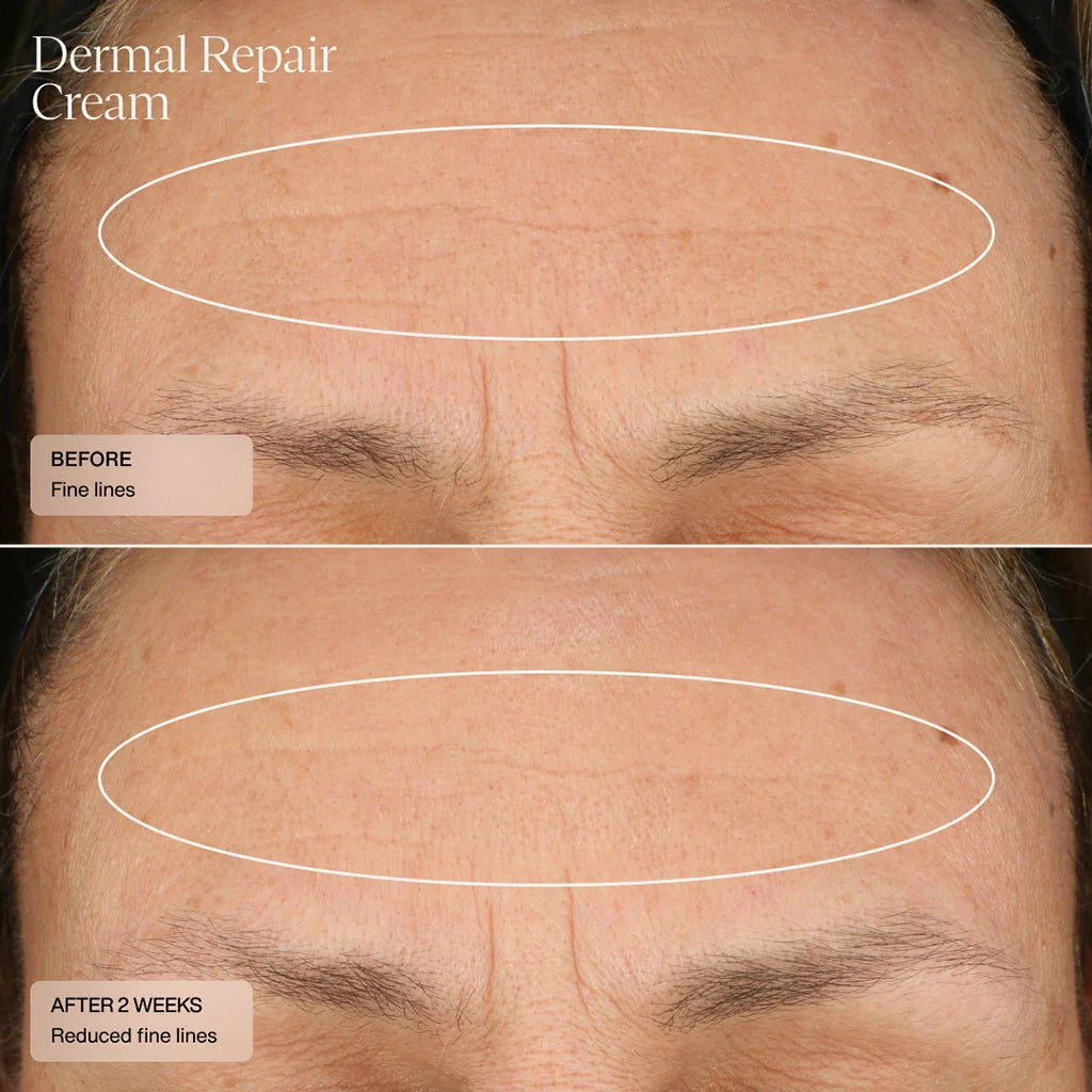 SENTÉ® Dermal Repair Cream