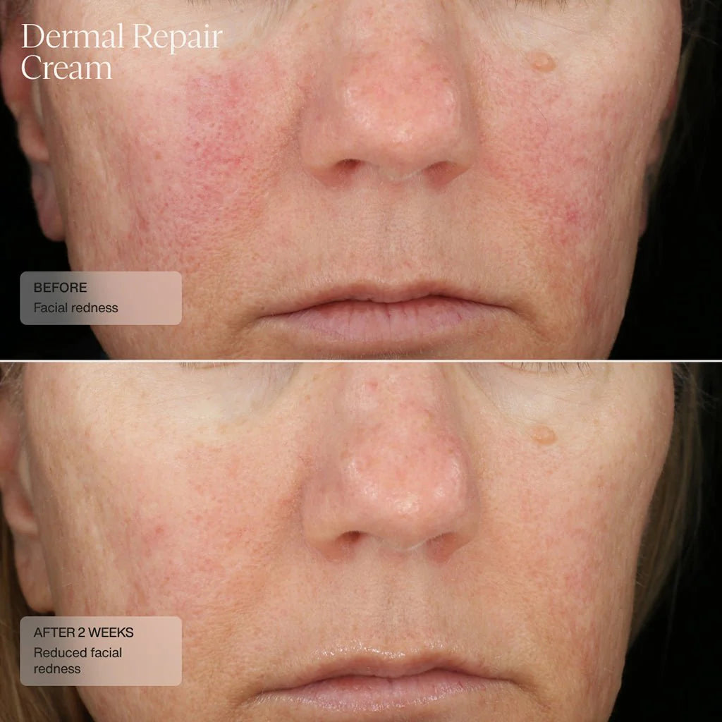 SENTÉ® Dermal Repair Cream