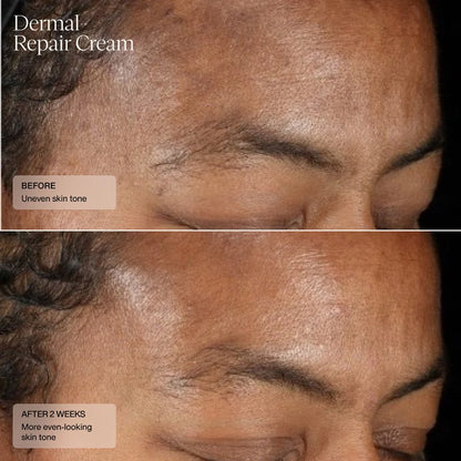 SENTÉ® Dermal Repair Cream