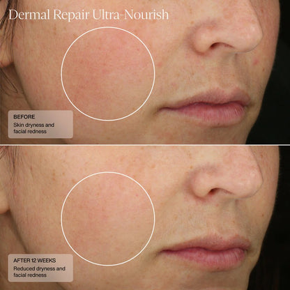 SENTÉ Dermal Repair Ultra-Nourish