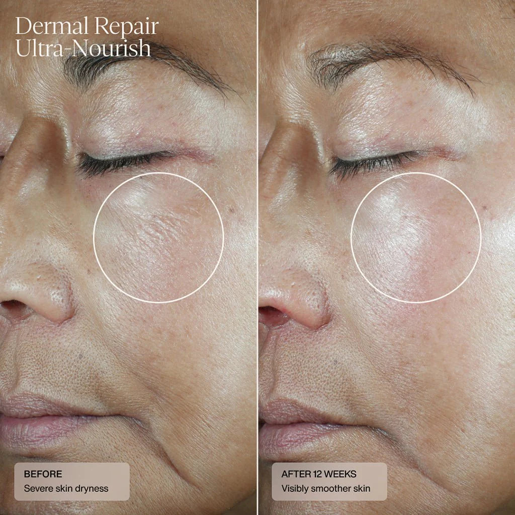 SENTÉ Dermal Repair Ultra-Nourish