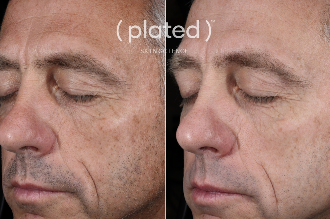 Plated™ INTENSE Serum