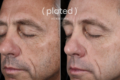 Plated™ INTENSE Serum