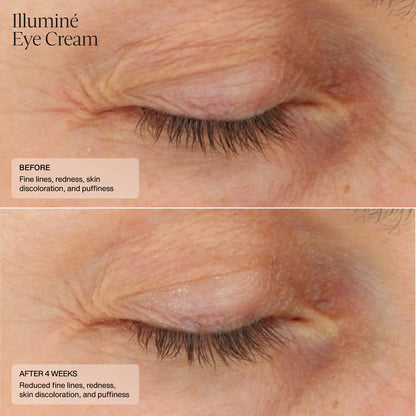 SENTÉ Illuminé Eye Cream®