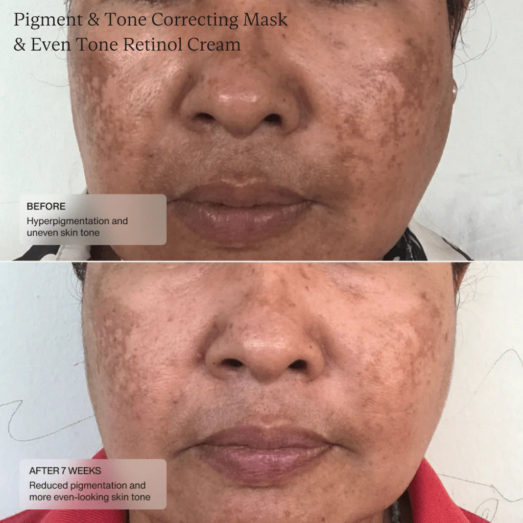 SENTÉ Cysteamine Pigment & Tone Correcting Mask (Formerly Cyspera)