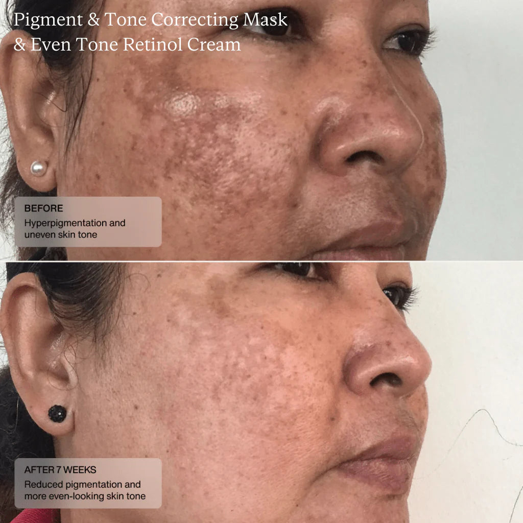 SENTÉ Cysteamine Pigment & Tone Correcting Mask (Formerly Cyspera)