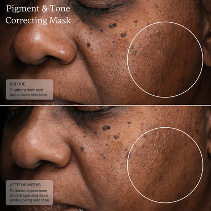 SENTÉ Cysteamine Pigment & Tone Correcting Mask (Formerly Cyspera)