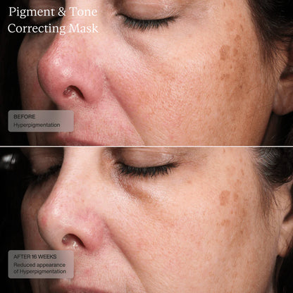 SENTÉ Cysteamine Pigment & Tone Correcting Mask (Formerly Cyspera)