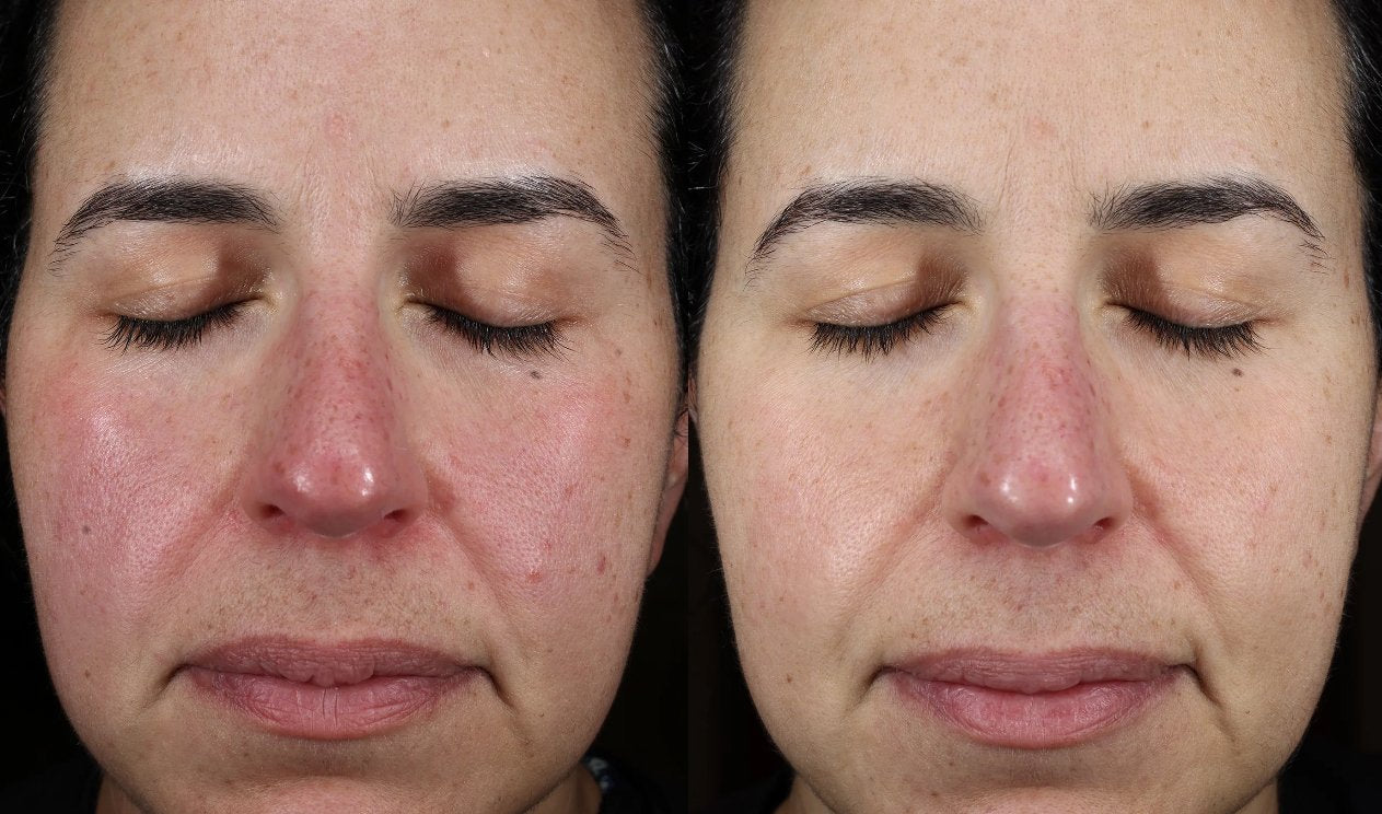 Plated™ INTENSE Serum