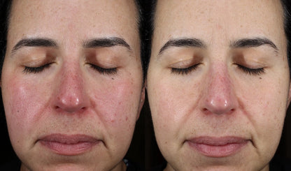 Plated™ INTENSE Serum