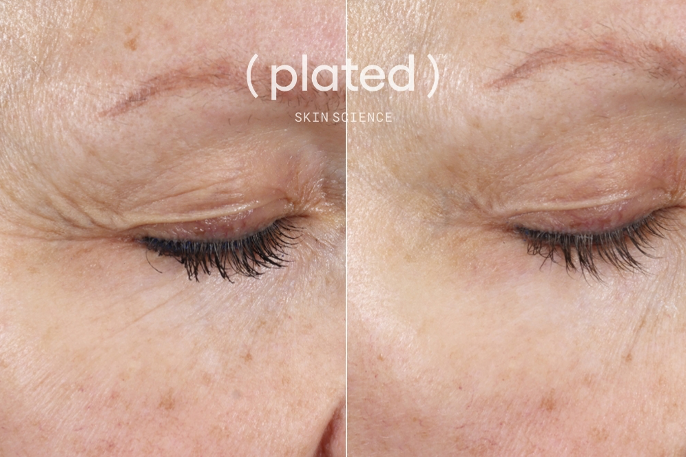 Plated™ INTENSE Serum